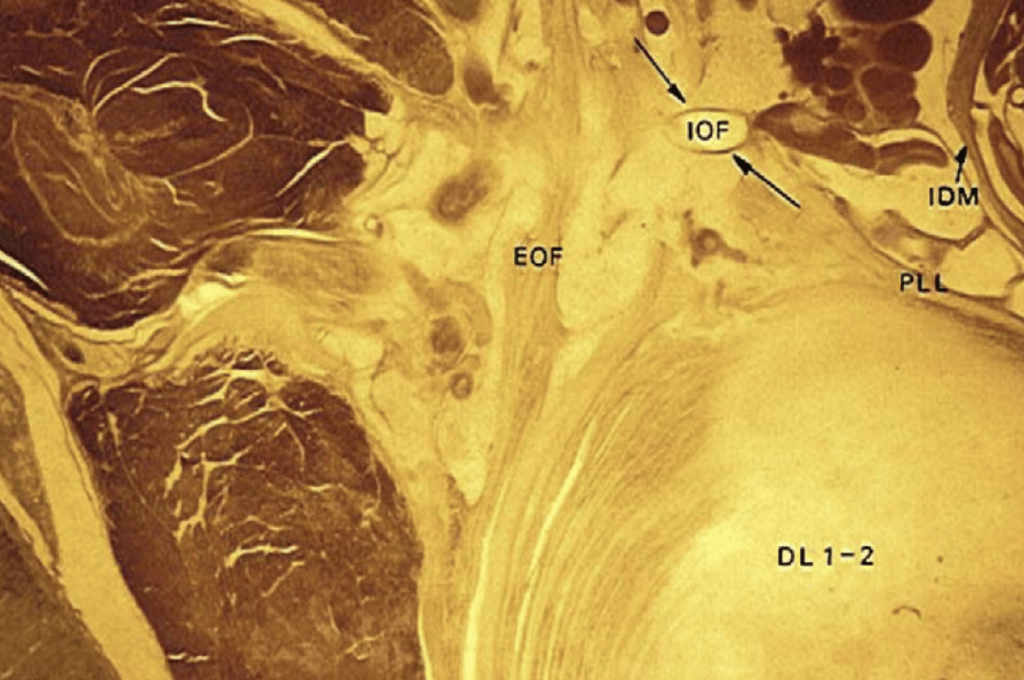Więzadła oponowe widziane w preparacie zarodka. Zewnętrzne i wewnętrzne Nakrywki Forestiera.